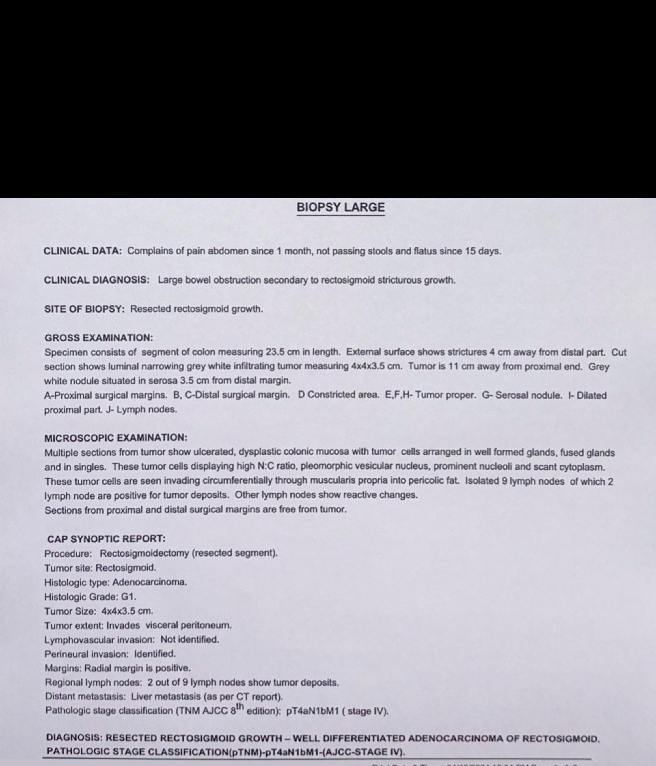 Rectosigmoidectomy specimen biopsy report—well-differentiated adenocarcinoma (pT4aN1bM1-stage IV) with negative proximal and distal margins of the tumour.